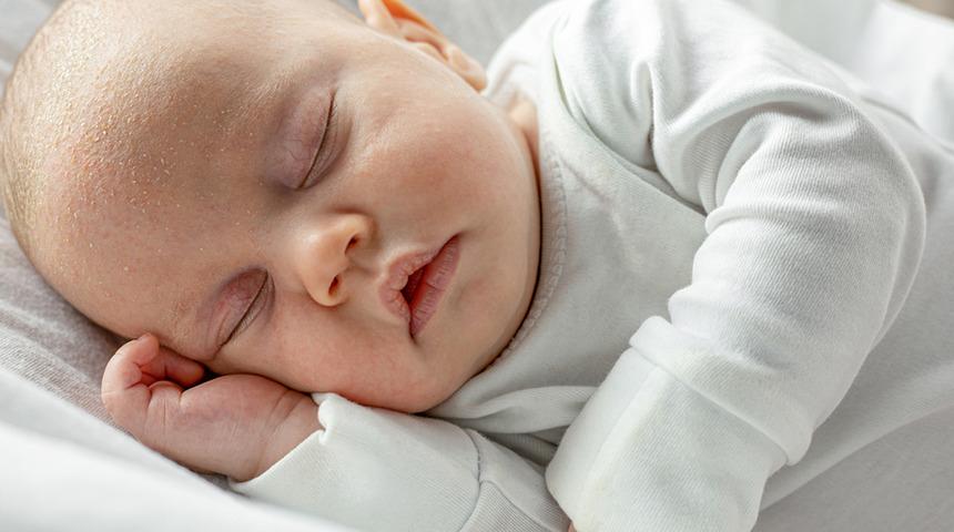 Bebeklerde kafatası şekil bozukluğu neden olur? Önlemek için...