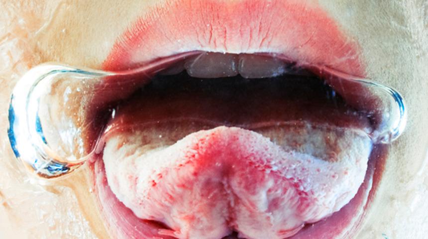 Kan şekeri neden yükselir? İşte belirtileri ve kan şekerini yükselten 10 hata