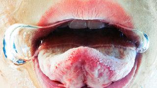 Kan şekeri neden yükselir? İşte belirtileri ve kan şekerini yükselten 10 hata