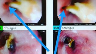 Yediği turpun yemek borusunu deldiğini sandı, gerçek bambaşka çıktı!