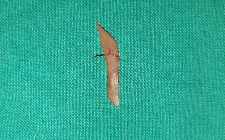 Yediği turpun yemek borusunu deldiğini sandı, gerçek bambaşka çıktı! G3