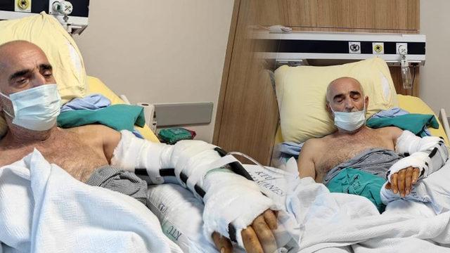 Vahim iddia: Kolunda hiç et yok, sadece kemik var