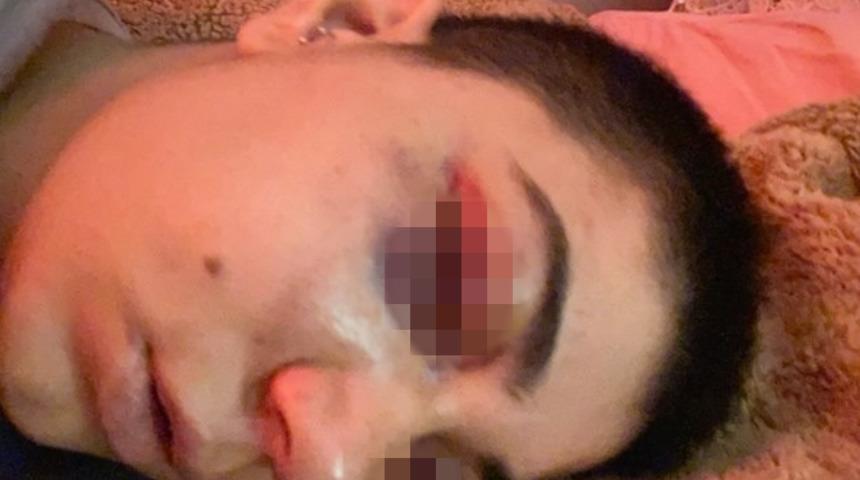 Taksim'de dehşeti yaşadı! Yabancı uyruklu şahıstan genç kızı felç eden dayak: Ameliyata girersek elimde kalırsın