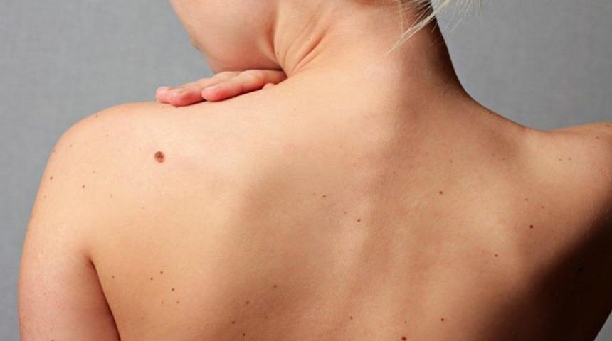 "Ben"ler kanserin habercisi