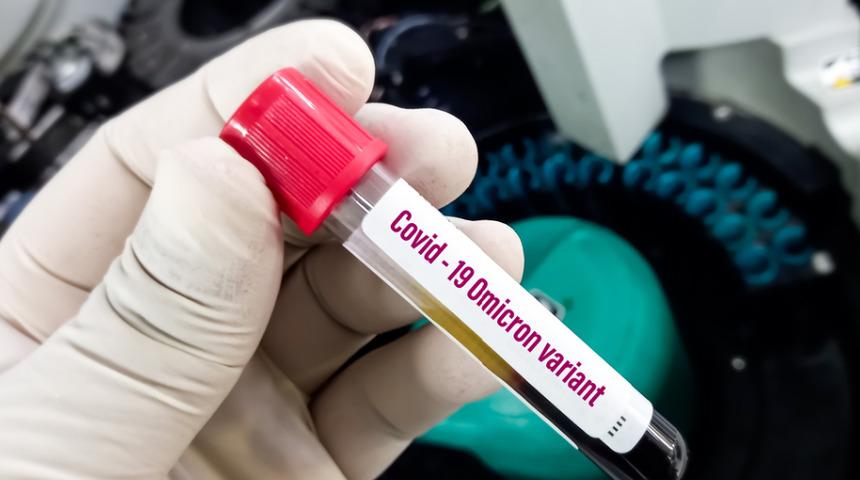 DSÖ 'endişe verici' diye uyarıyor, uzmanlar ''diğerlerinden çok farklı'' diyor! İşte Omicron varyantı hakkında bilinmesi gerekenler