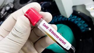 DSÖ 'endişe verici' diye uyarıyor, uzmanlar ''diğerlerinden çok farklı'' diyor! İşte Omicron varyantı hakkında bilinmesi gerekenler