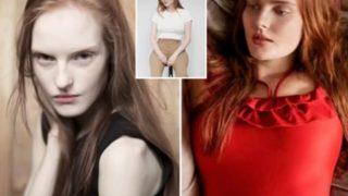 Büyük beden model olmak için kilo almaya başladı! Değişimi herkesi şaşırttı