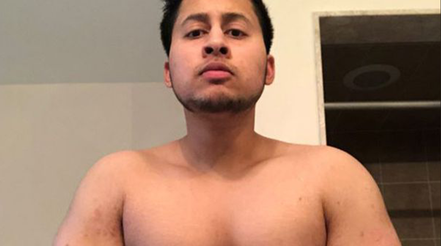 Cinsel organını bile kaplamıştı! Sedef hastalığıyla mücadele eden vücut geliştirmeni sosyal medya ilham oldu