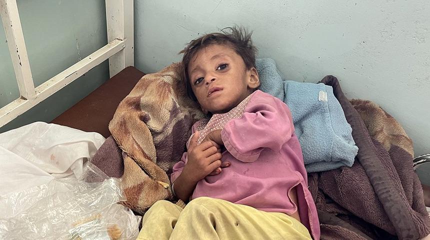 Afganistan'da sağlık krizi: A&ccedil;lık sınırındaki bebekleri tedavi eden doktorlar anlatıyor
