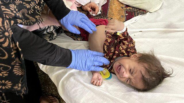 Afganistan da sağlık krizi: Açlık sınırındaki bebekleri tedavi eden doktorlar anlatıyor 1