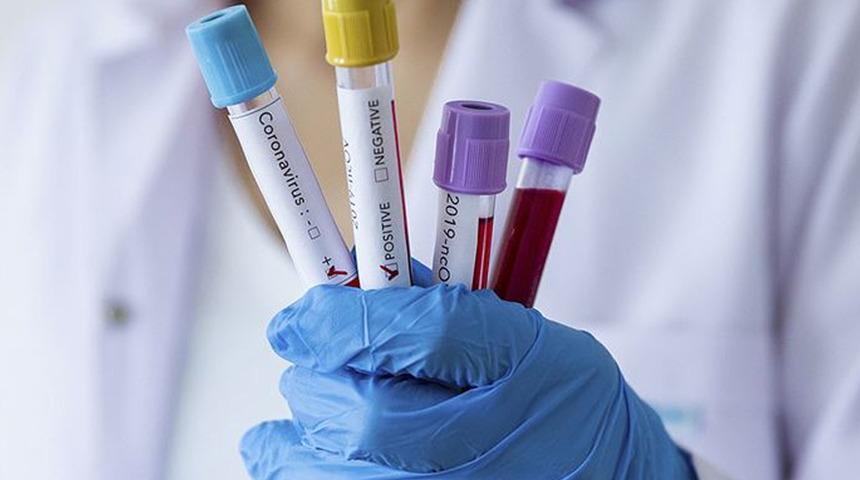 D&uuml;nyada Omicron paniği! Bir &uuml;lkede daha g&ouml;r&uuml;ld&uuml;