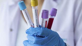 Dünyada Omicron paniği! Bir ülkede daha görüldü