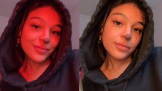 Burnundaki doğum lekesiyle alay edenlere meydan okudu! Beden pozitifliğini savundu