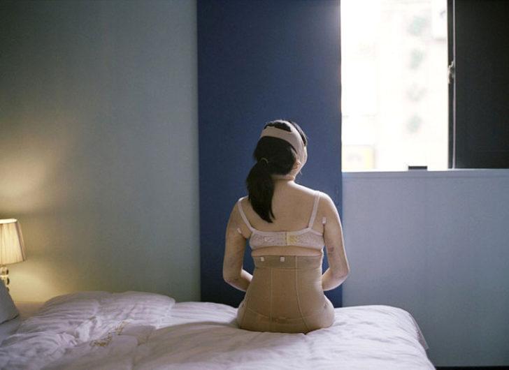 Estetik ameliyat sonrası tanınmaz hale geldiler G3