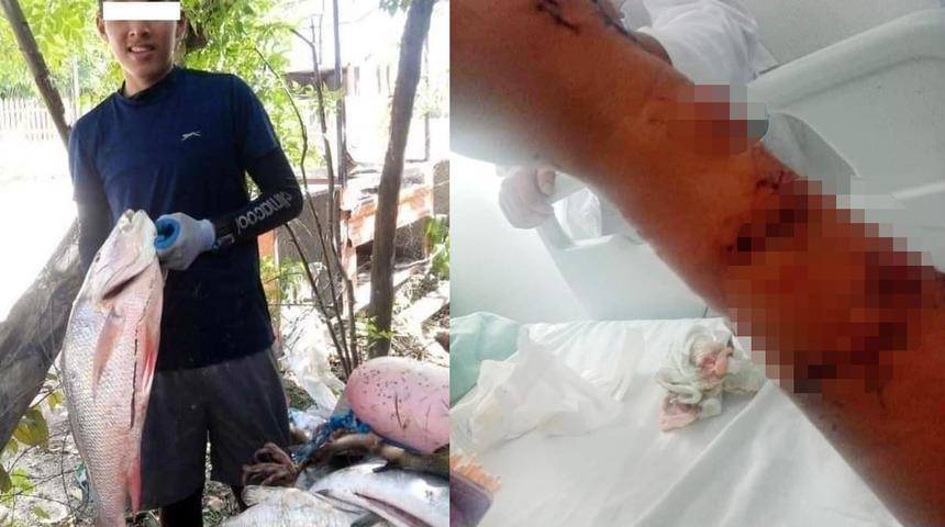 Belgesel hayat kurtardı! Köpek balığından akla gelmeyecek yöntemle kurtuldu