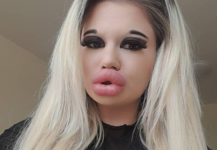 Dünyanın en büyük dudaklarına sahip olduğunu iddia eden Andrea Ivanova, Barbie bebeğe dönüşmek istiyor