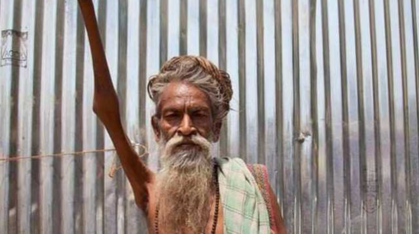 Tam 45 yıldır sağ eli havada! Eli tamamen işlevini kaybetti