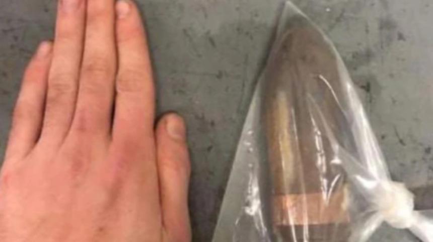 Ayağı kayıp, üzerine düştü! İngiliz adamın rektumundan mermi çıktı