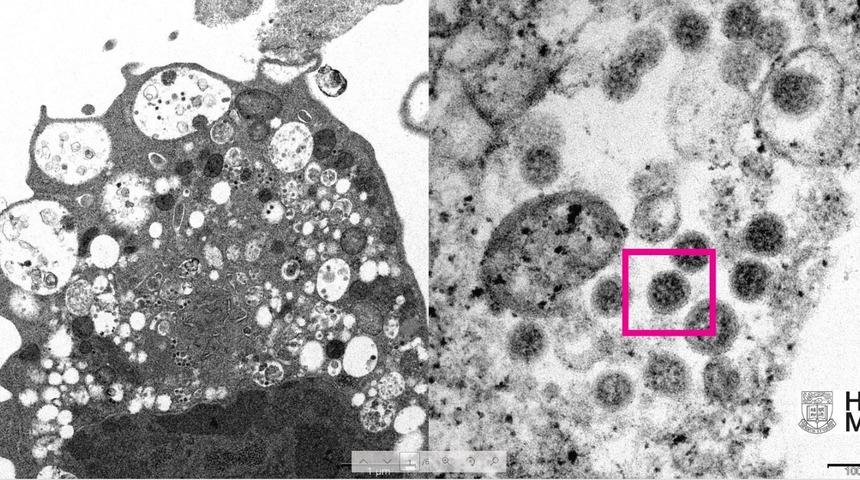 Dünyayı ayağa kaldırdı! Omicron varyantının elektron mikroskobu görüntüsü yayınlandı