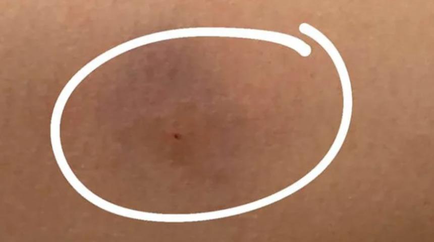 Barda eğlenen kadınlara iğneli saldırı! ''Uyluk bölgesinden enjekte edildi''