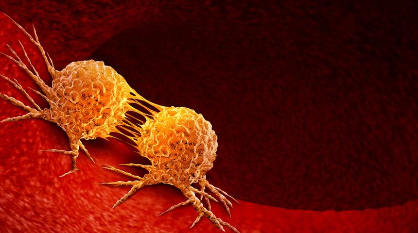 Akciğer kanseri belirtileri hastalığın sinsice ilerlemesini önlüyor! 