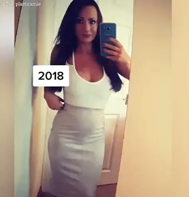 Estetik ameliyat bağımlılığı bulunan kadın eski halini paylaştı! Görenler inanamadı G1