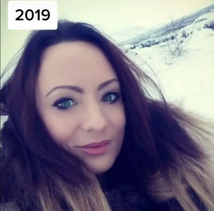 Estetik ameliyat bağımlılığı bulunan kadın eski halini paylaştı! Görenler inanamadı G2