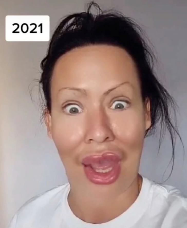 Estetik ameliyat bağımlılığı bulunan kadın eski halini paylaştı! Görenler inanamadı G4