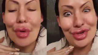 Estetik ameliyat bağımlılığı bulunan kadın eski halini paylaştı! Görenler inanamadı