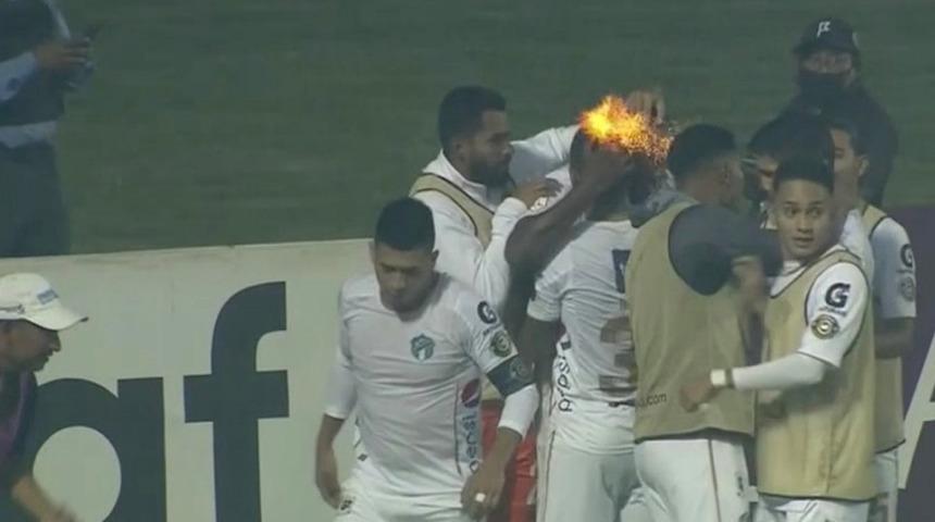 Concacaf Ligi'ndeki maçta oyuncunun başı bir anda alev aldı