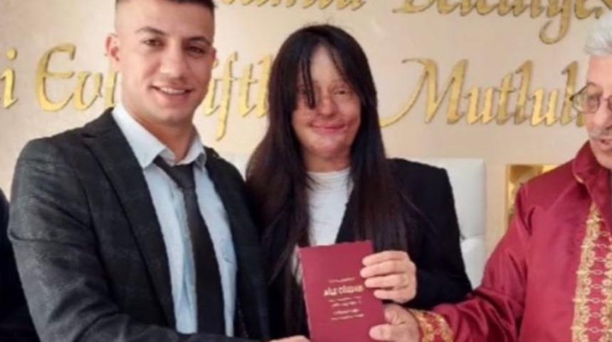 Yüzüne asit atmıştı! Şikayetini geri çekti ve evlendi
