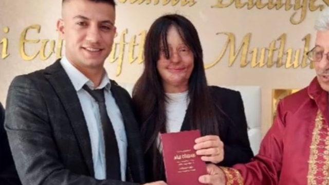 Yüzüne asit atmıştı! Şikayetini geri çekti ve evlendi