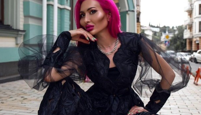 Dünyanın en büyük yanaklarına sahip modeli Anastasia Pokreshchuk, estetik operasyonlardan önceki halini paylaştı