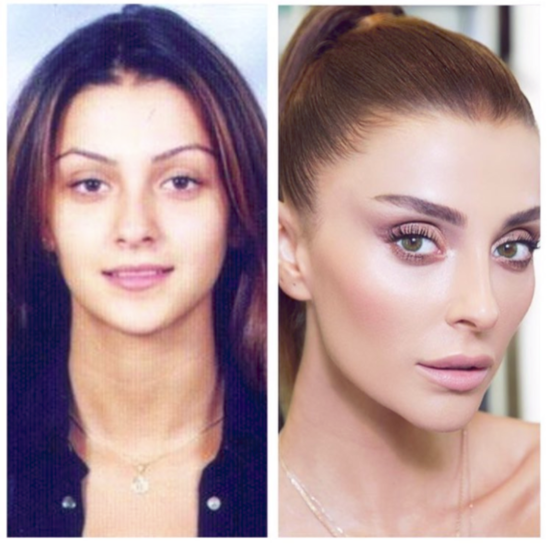 Özge Ulusoy