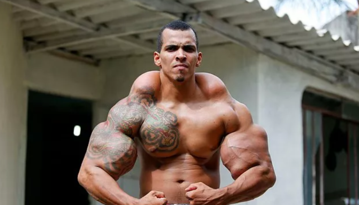 Brezilyalı ‘Hulk’ olarak biliniyor! Hayatını riske atan bir vücut geliştiricisi:  Romario Dos Santos