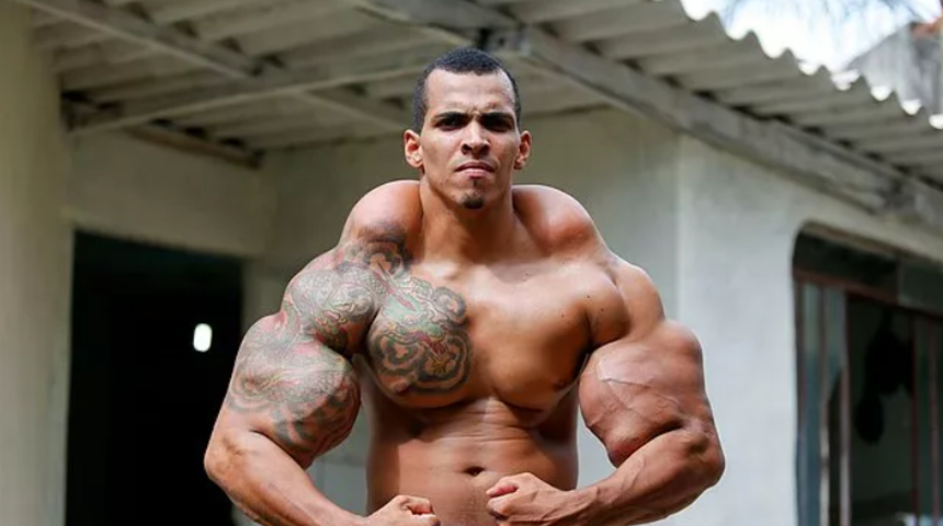Brezilyalı ‘Hulk’ olarak biliniyor! Hayatını riske atan bir vücut geliştiricisi:  Romario Dos Santos