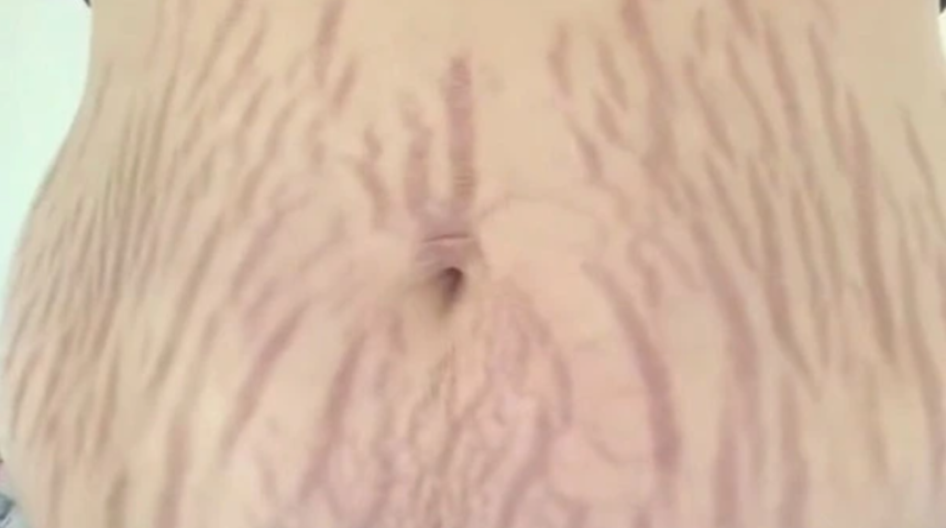 Doğum yaptıktan sonra vücudunun değişimini gösterdi! “Gurur duyuyorum”