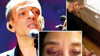 Rubato grubunun solisti Özer Arkun'un, kız arkadaşını darbettiği gerekçesiyle yargılandığı davada yeni gelişme