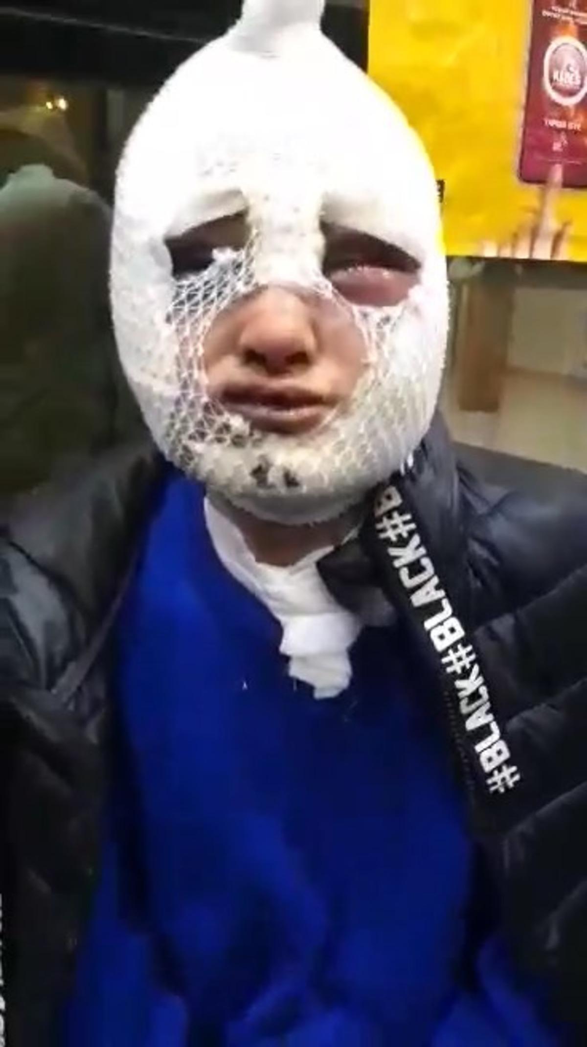 Evini bastığı eski s&ouml;zl&uuml;s&uuml;ne cinsel saldırıda bulunup başından aşağı kızgın yağ d&ouml;kt&uuml;