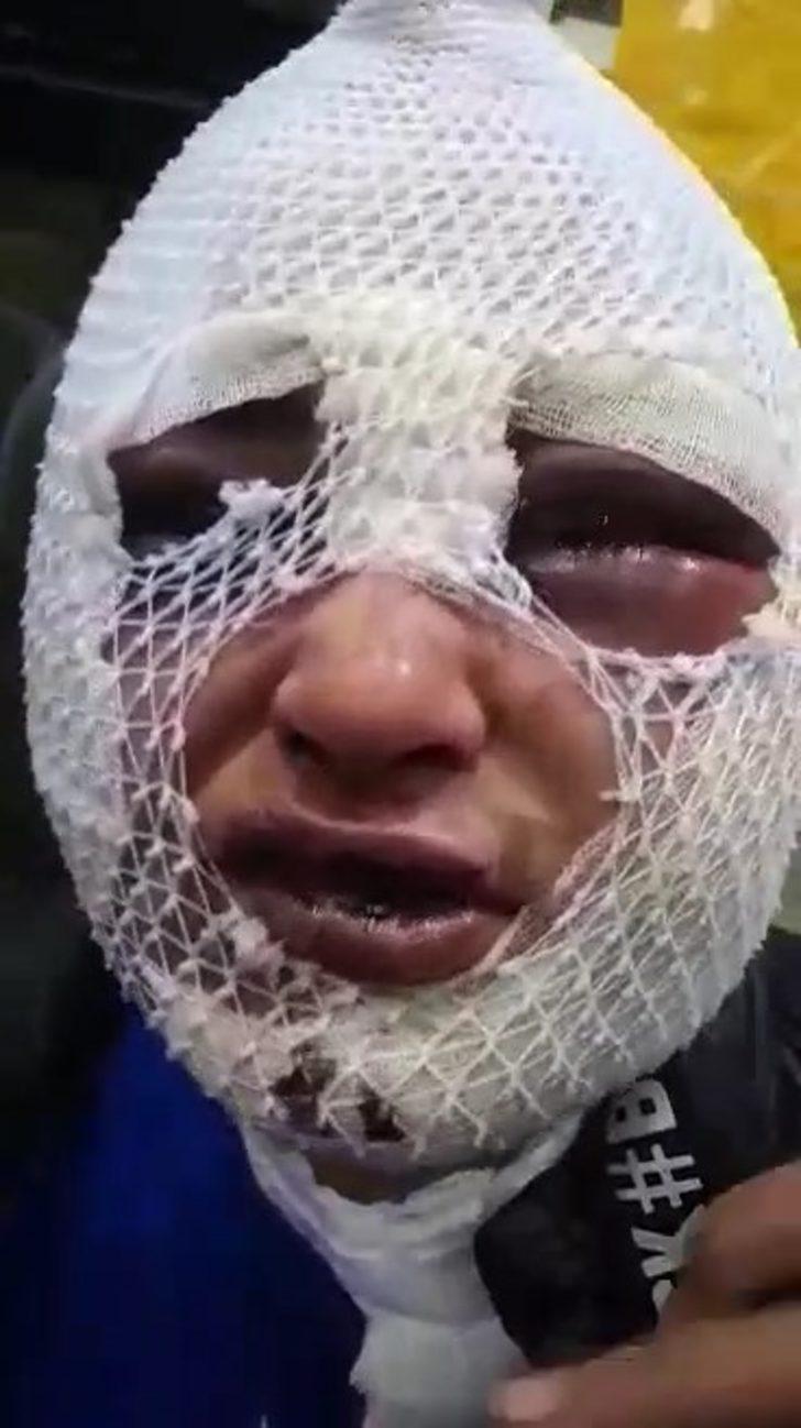 Evini bastığı eski sözlüsüne cinsel saldırıda bulunup başından aşağı kızgın yağ döktü G2