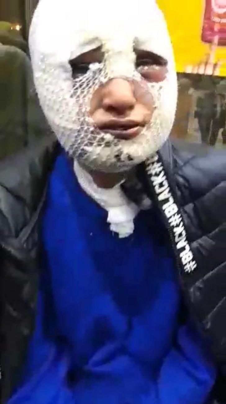 Evini bastığı eski sözlüsüne cinsel saldırıda bulunup başından aşağı kızgın yağ döktü G3