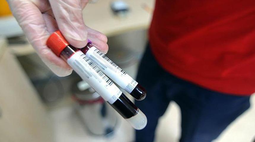 Umut vadeden gelişme! Kan testiden akciğer teşhisi
