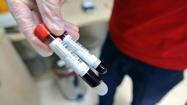 Umut vadeden gelişme! Kan testiden akciğer teşhisi