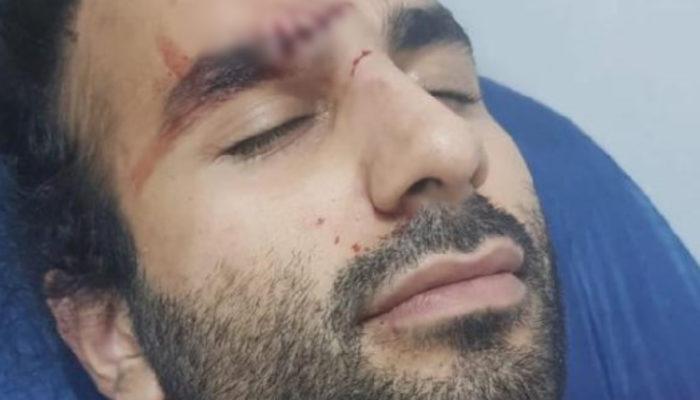 Aydın'da doktora saldırı! Alkollü geldiği hastanede kafa atıp kaş yardı