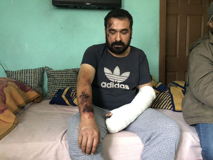 Öldüğünü sanan yaralı madenci patlama anını anlattı: Ayağımın yerden kesildiğini hissettim, emekleyerek dışarı çıktım G3