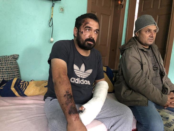 Öldüğünü sanan yaralı madenci patlama anını anlattı: Ayağımın yerden kesildiğini hissettim, emekleyerek dışarı çıktım G4