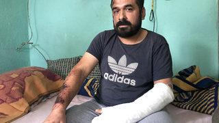 Öldüğünü sanan yaralı madenci patlama anını anlattı: Ayağımın yerden kesildiğini hissettim, emekleyerek dışarı çıktım