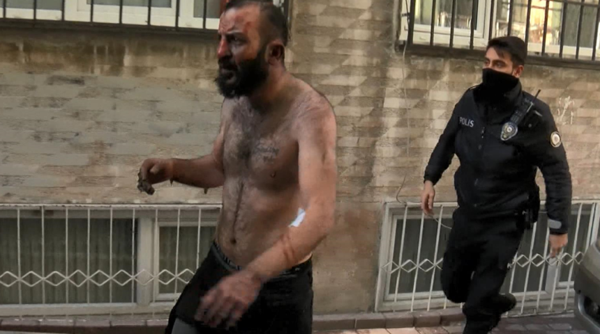 İstanbul Fatih'te ilginç anlar! Yaralı halde ambulanstan inip yanan evini gezdi