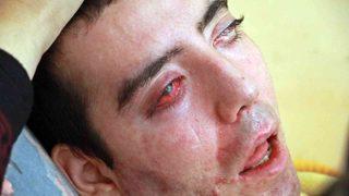 Yürek yakan görüntü! 8 yıldır gözlerini kırpamıyor, adeta kan ağlıyor