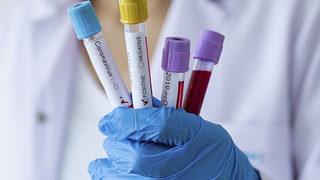 SON DAKİKA | Omicron bir ülkede daha görüldü